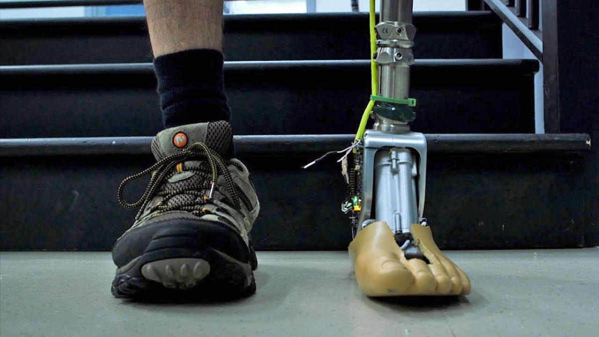 Artificial foot