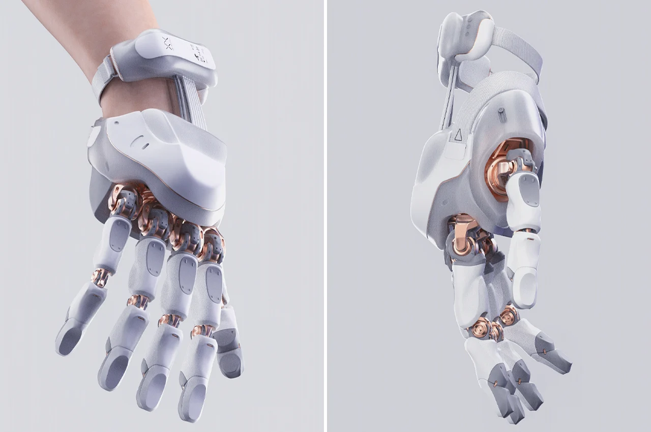 How AI is Transforming Early Prosthetic Design