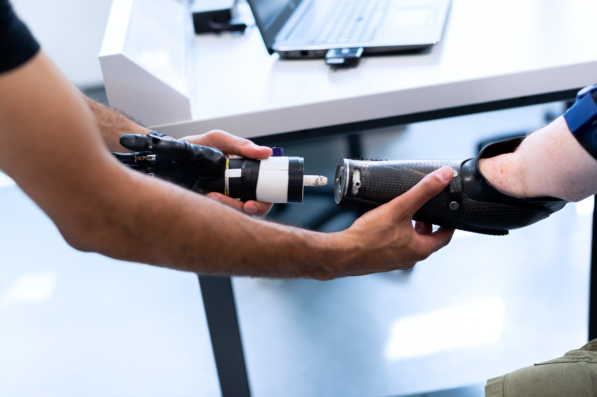 The Role of AI in the Development of Smart Prosthetics